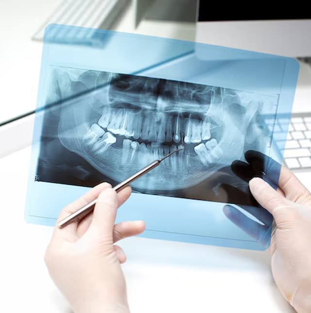 Digital-dental x-rays.jpg