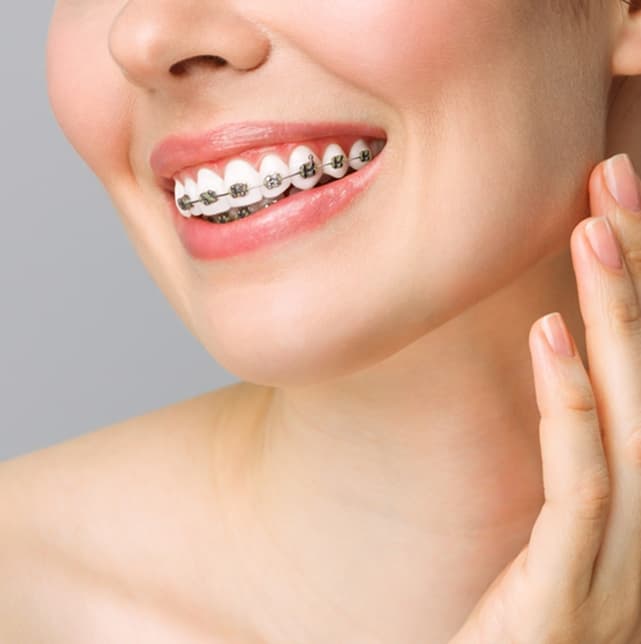 Orthodontic-Care.jpg