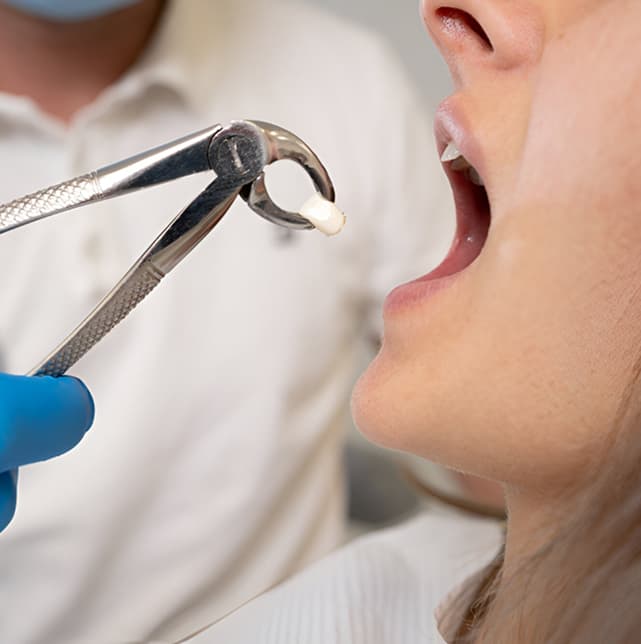 oral-surgery-services.jpg